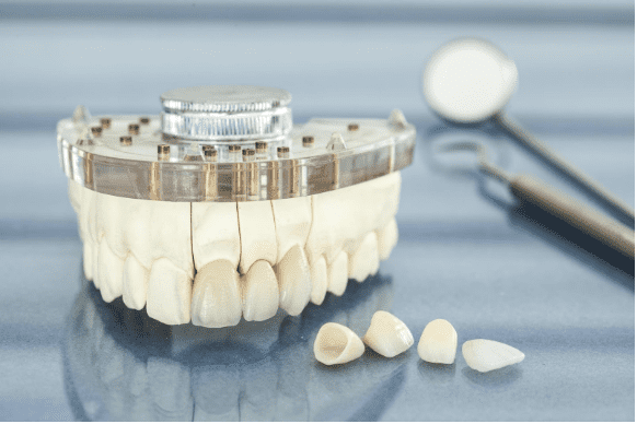 Everything To Know About Dental Crowns Made During Your Dentist's Visit 1 Screen Shot 2019 10 28 at 6.29.01 PM