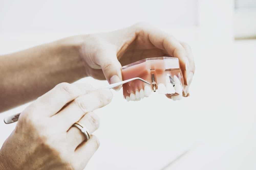 will insurance cover cosmetic dentistry